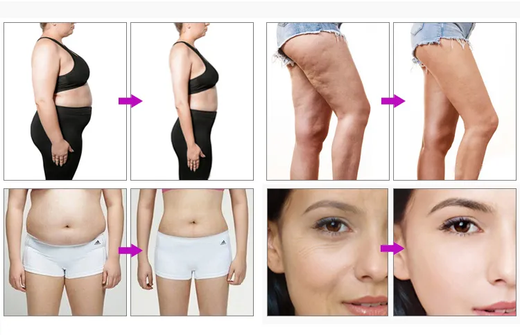 Before and After Results