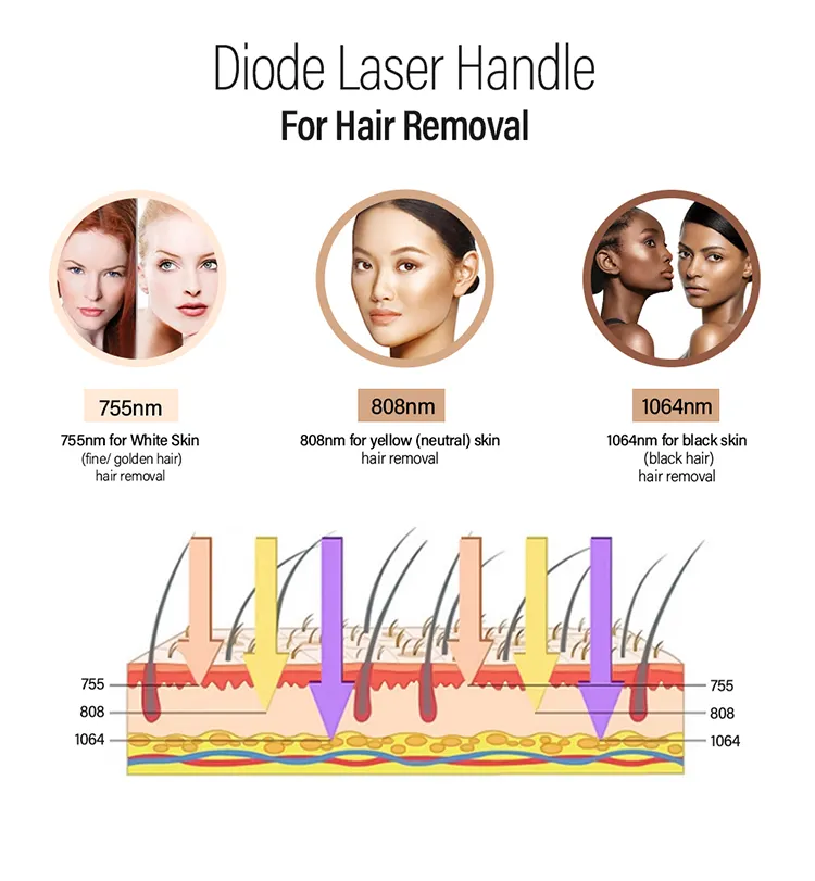 Diode Laser Machine View 2