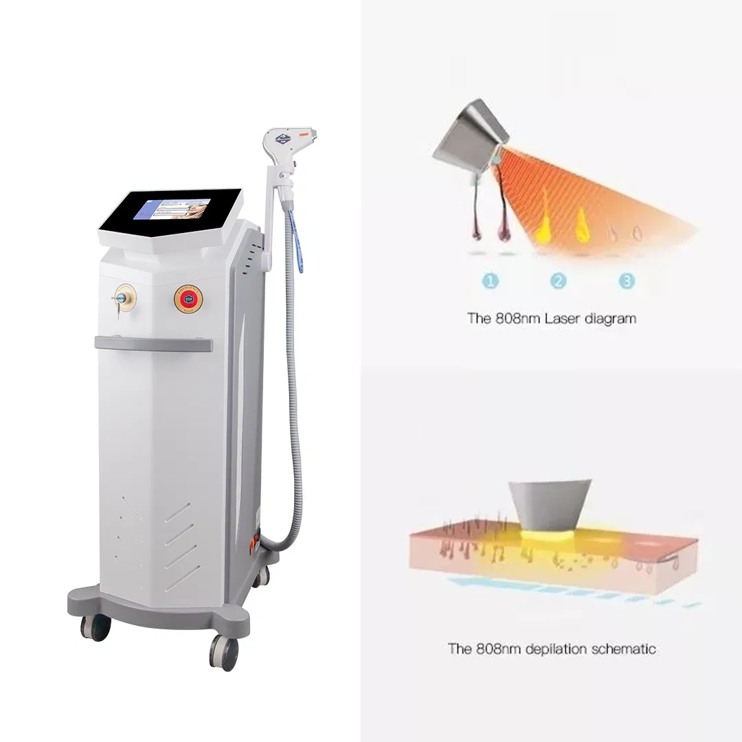 Professional Hair Removal Machine for Aesthetic Salon Use