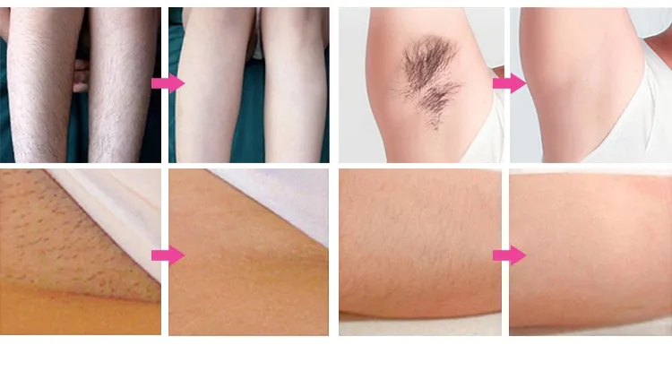 Before and After Treatment