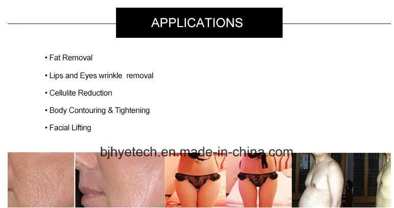 Treatment Areas