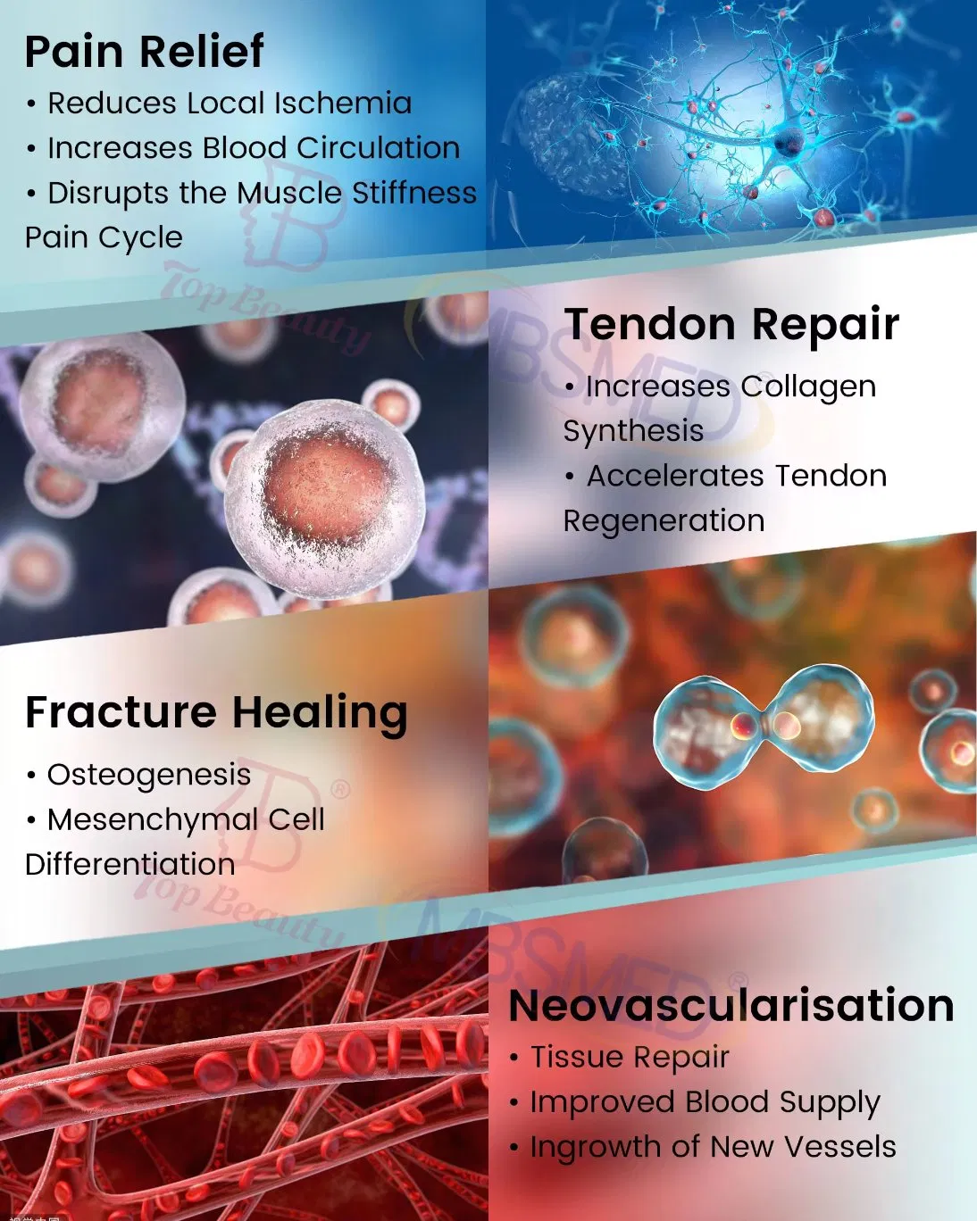 Eswt Shock Wave Machine Focused Therapy ED Erectile Pain Relief Dysfunction Physiothera Device