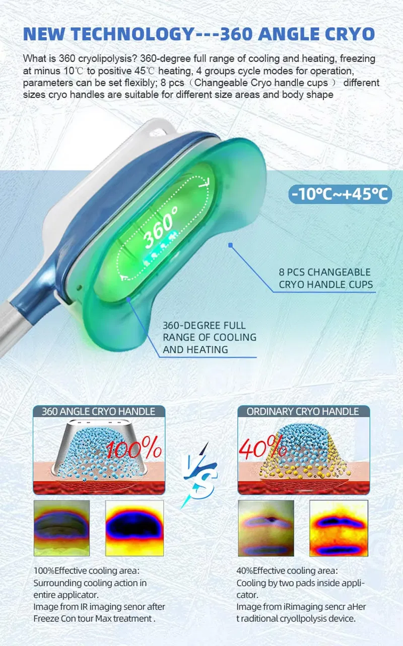 360 Angle Cryo Technology