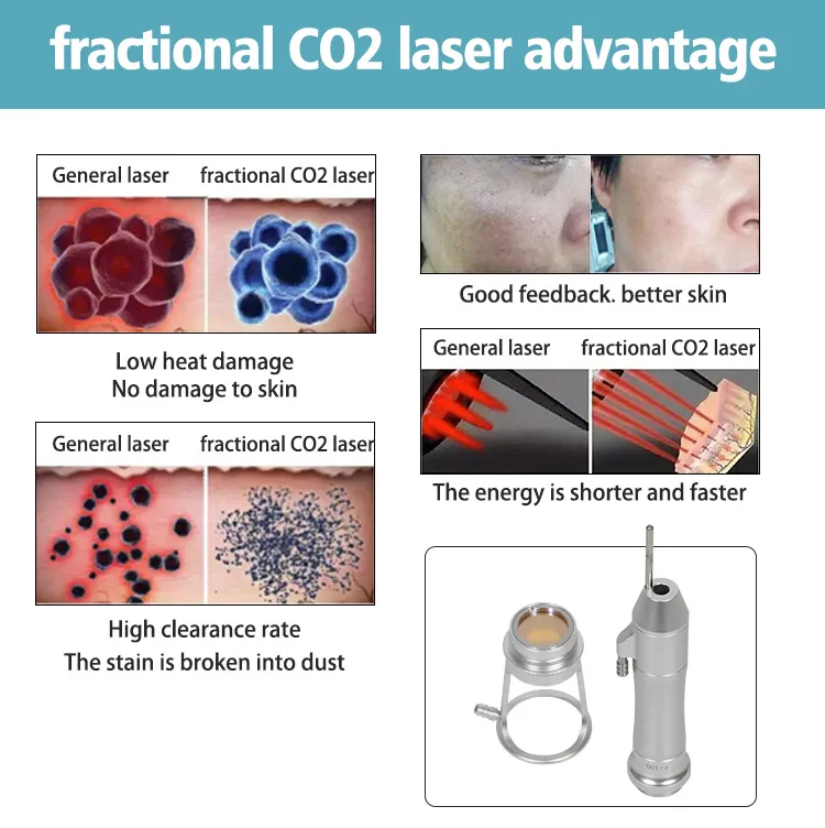 Technical Advantages