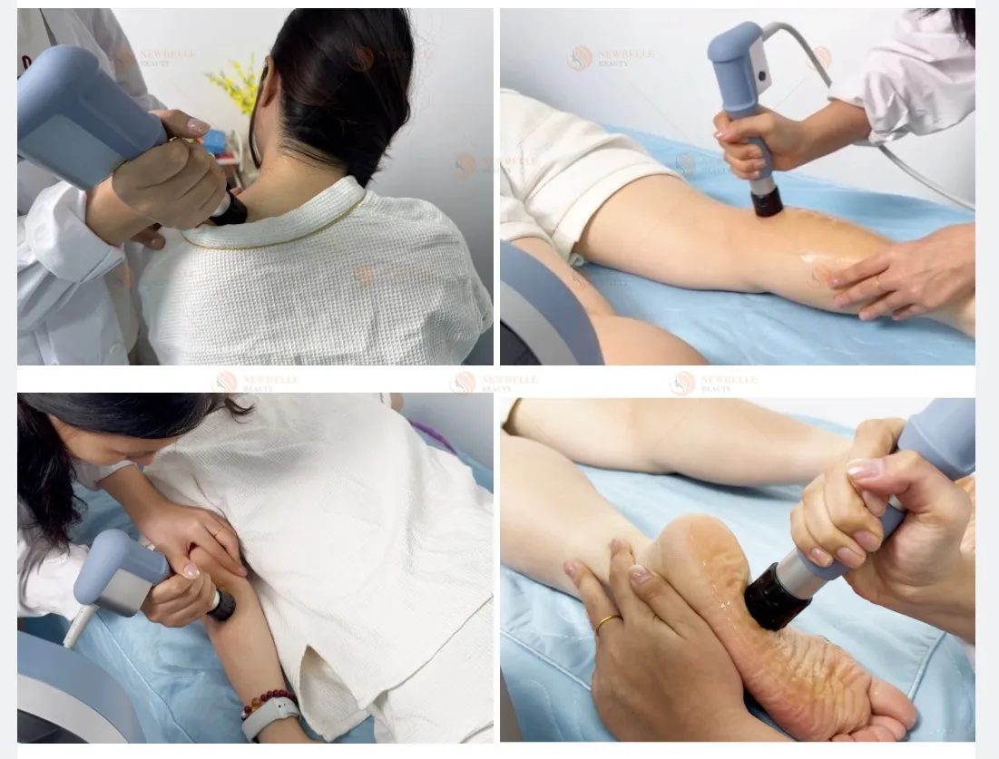Treatment Application