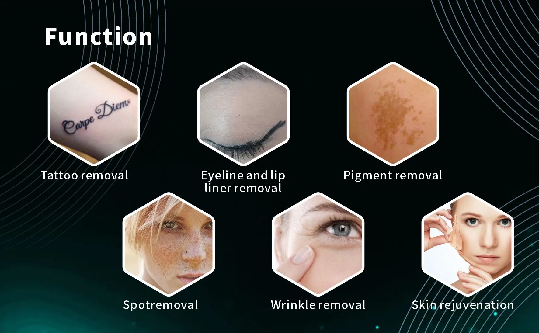 Tattoo Removal Process