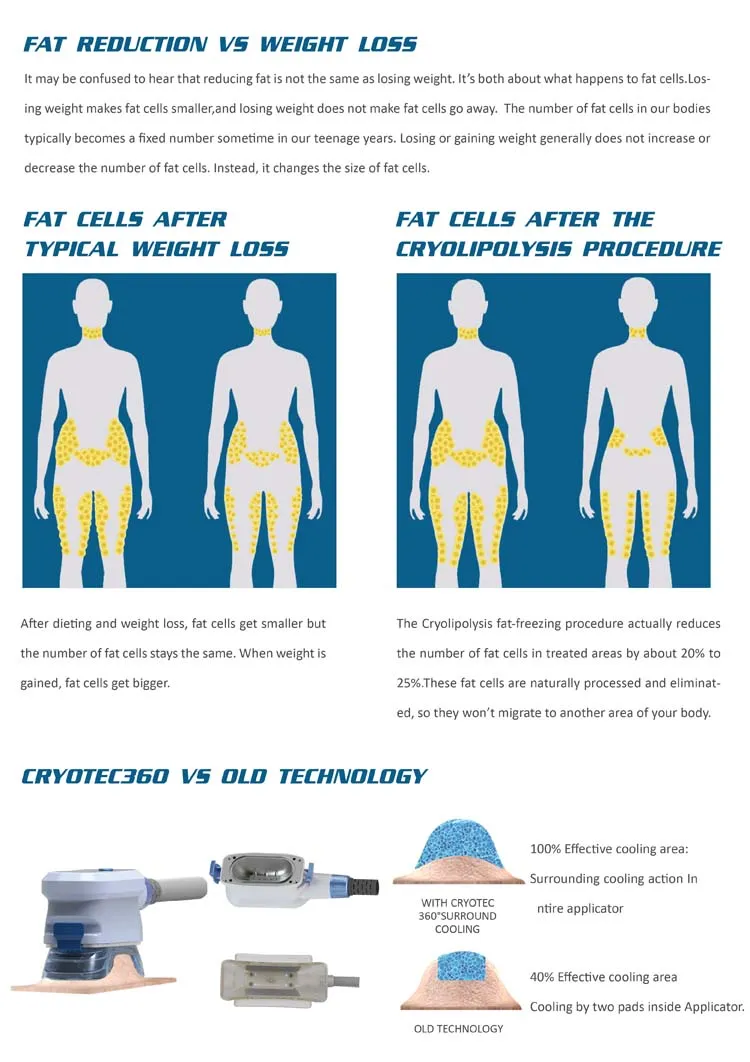 Fat Freeze Slimming Process