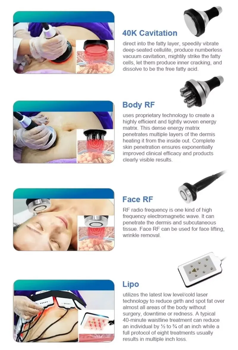 Cavitation and RF Technology