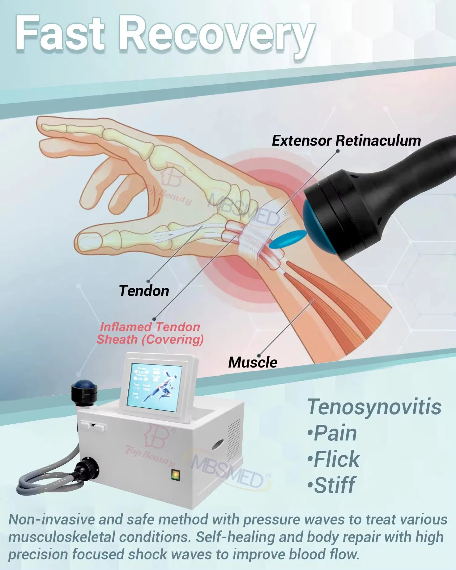 Eswt Shock Wave Machine Focused Therapy ED Erectile Pain Relief Dysfunction Physiothera Device