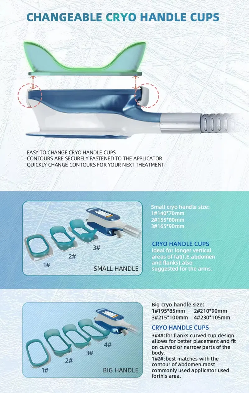 Cryo Handles Display