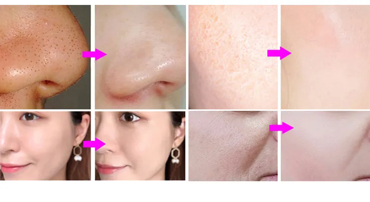 Before and After Results