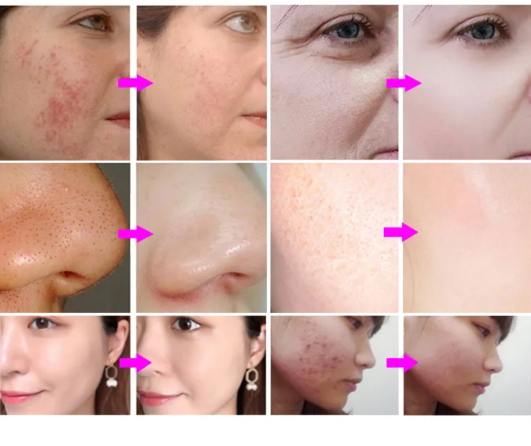 Treatment Result