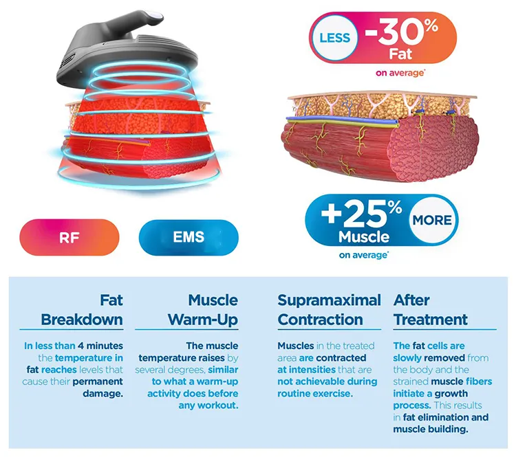 EMS Neo Treatment Effect