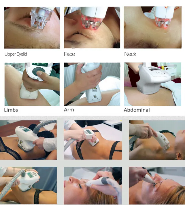 Treatment handles