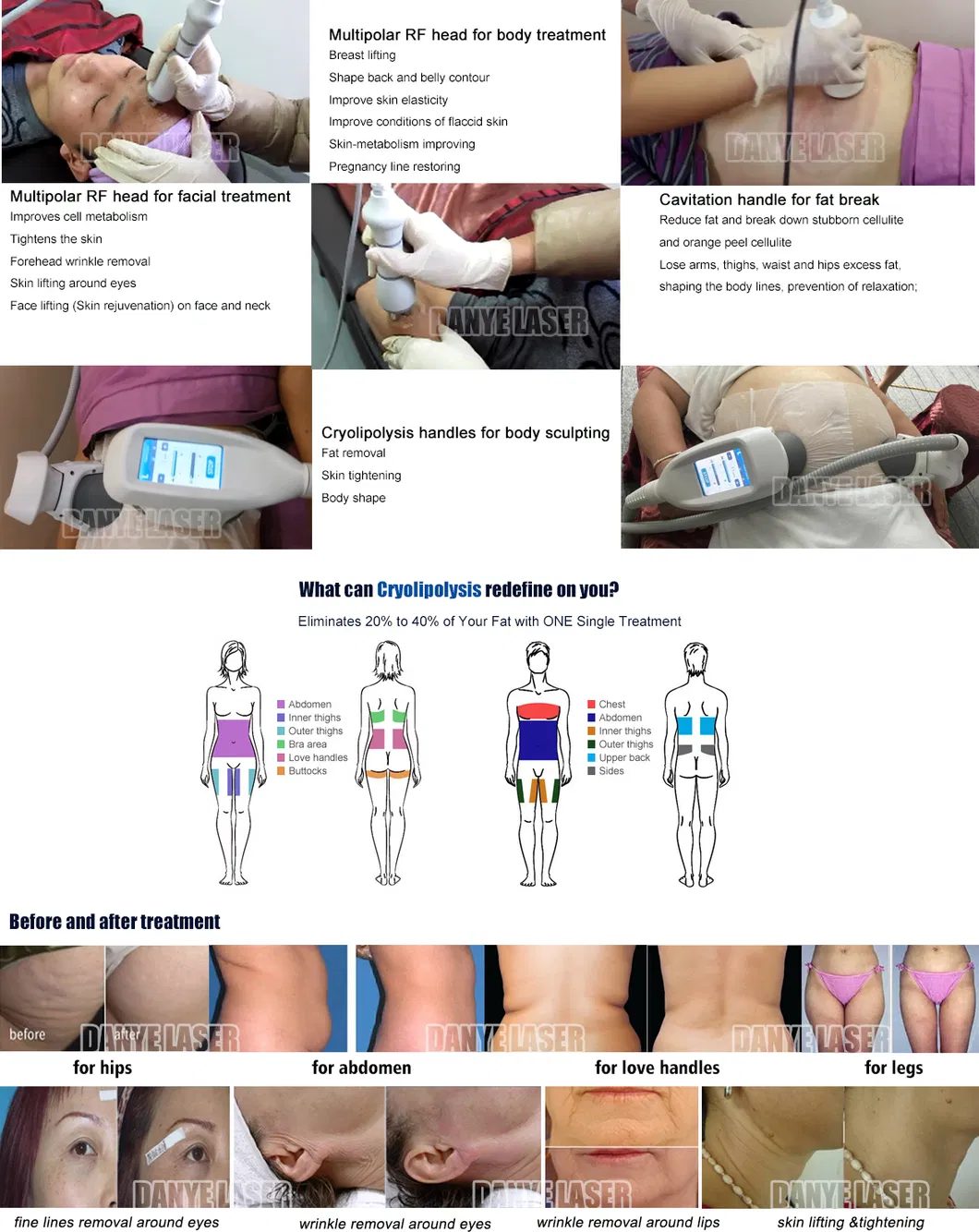 Treatment Process