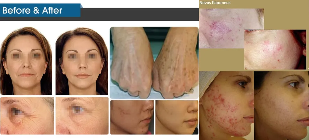 Treatment Results