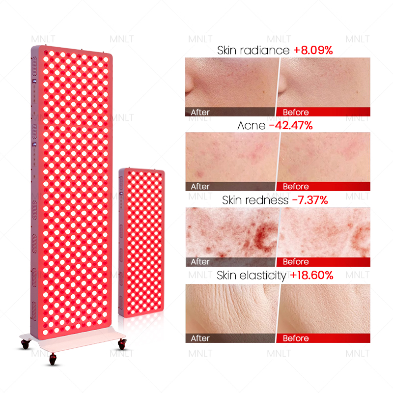 660nm 850nm PDT LED Facial Therapy Machine Infra Red Face Near Infrared Beauty Sauna Light