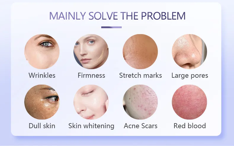 Skin Tightening Result