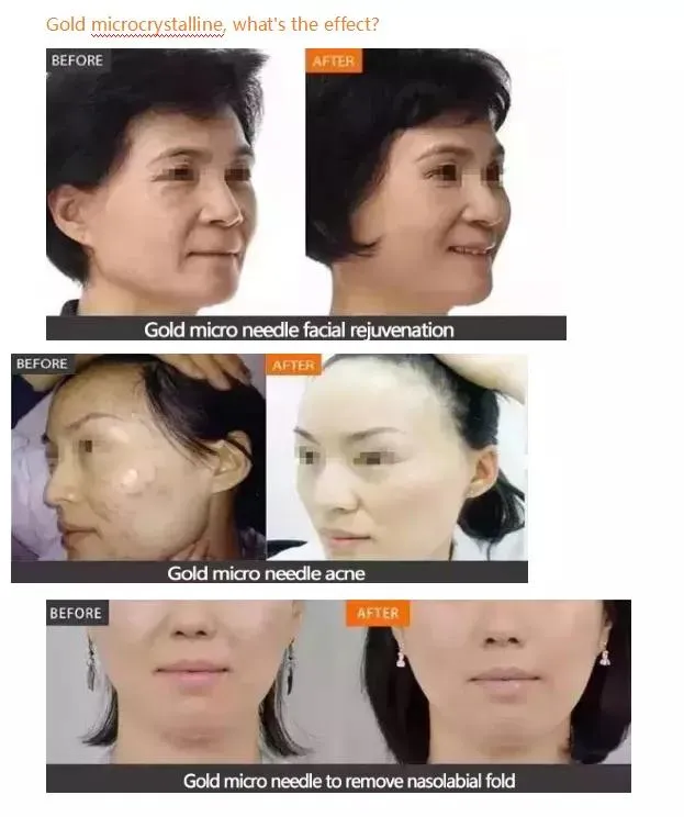 Before and After 3