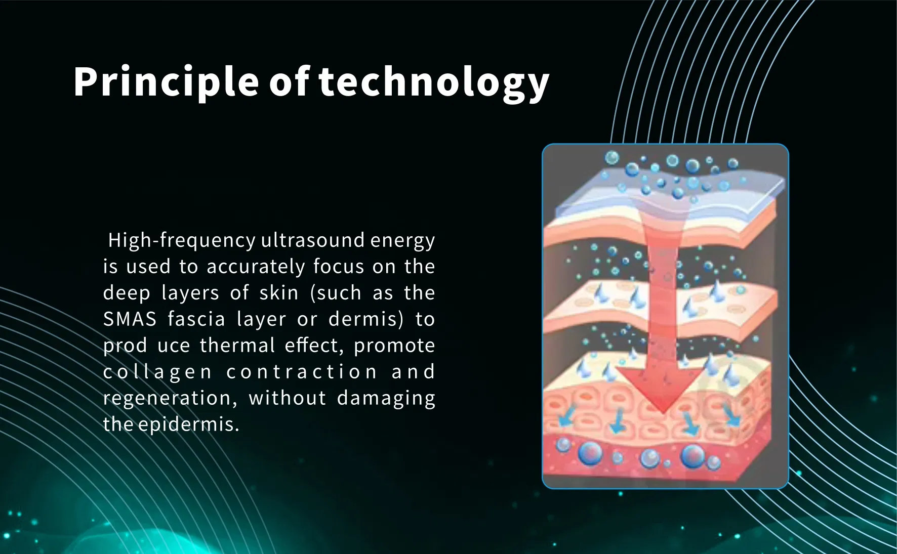 HIFU Treatment Visualization