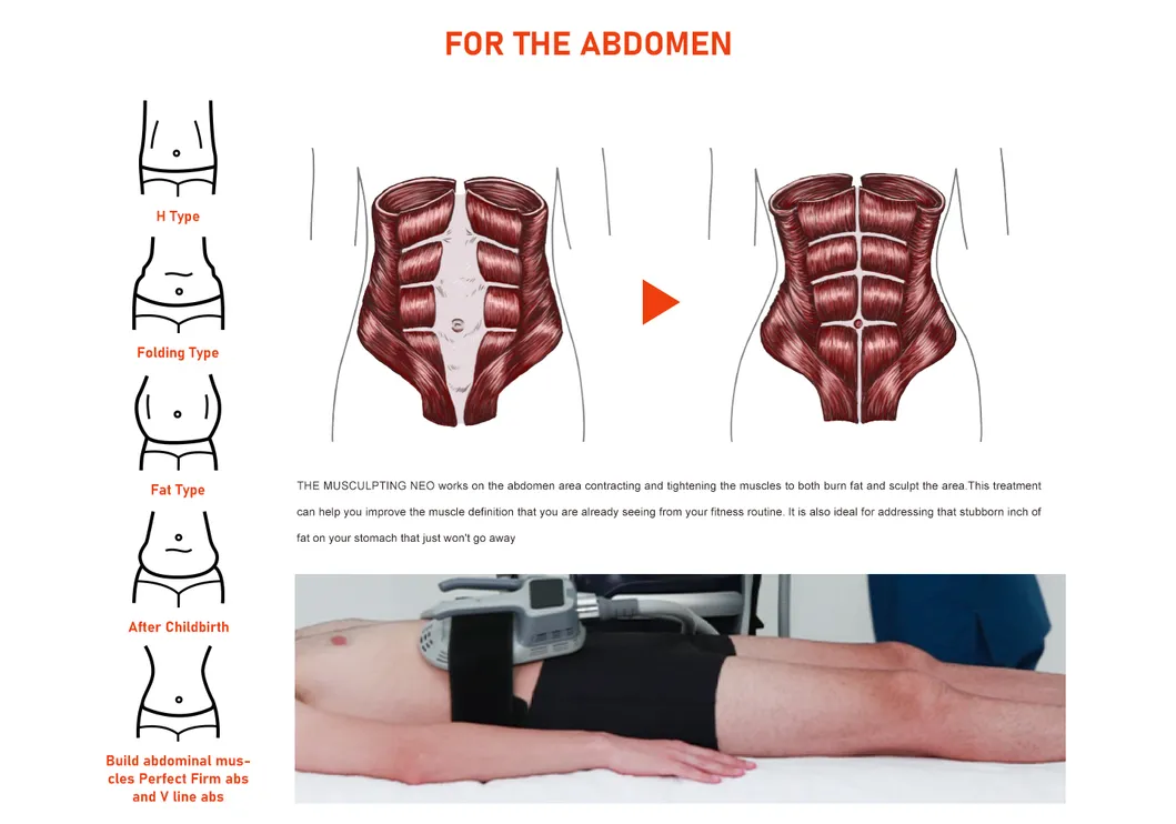 Butt Lift Procedure 1