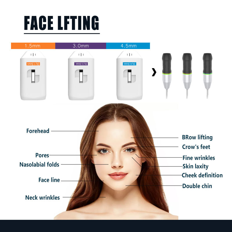 Most Advanced Face Wrinkle Removal Anti-Aging Face Lifting 4D Hifu Beauty Machine