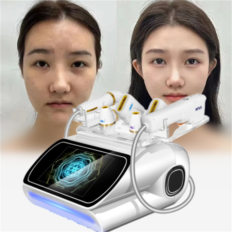Hifu 7D Machine Skin Lifting 7D Anti Aging Skin Tightening Machine Wrinkle Remover Machine High Intensity Focused Ultrasound