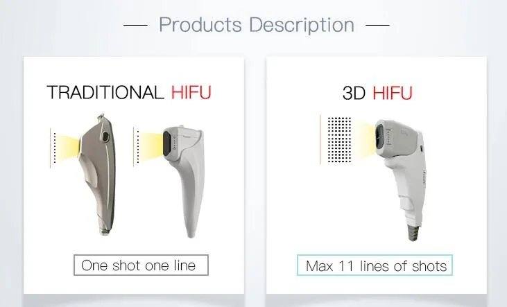 HIFU Effect 1