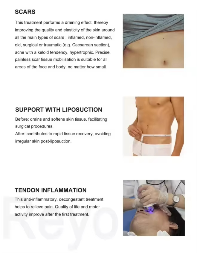 80K Cavitation Slimming Machine Vacuum Cavitation System Warhammer 40K Lipo Cavitation Starvac Vela Liposuction Shape Machine