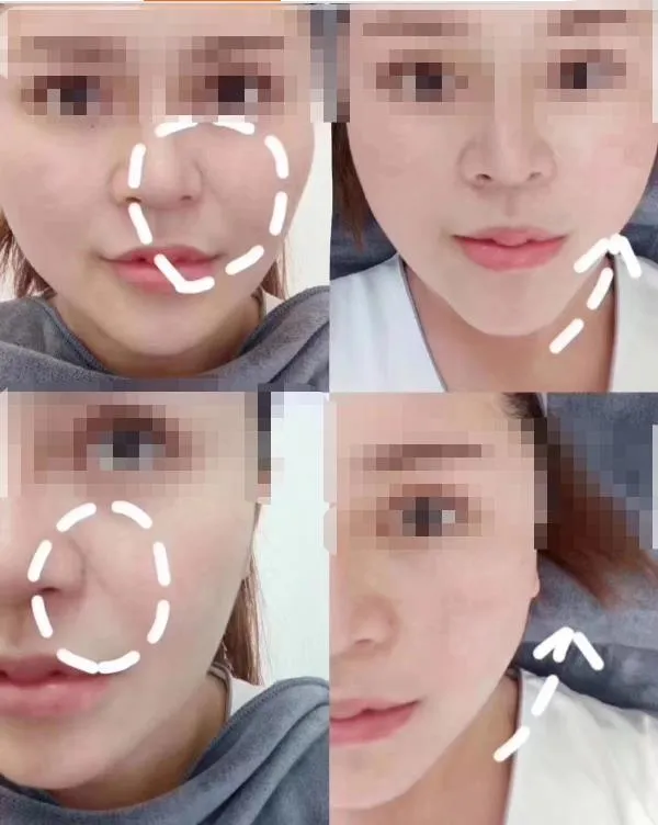 Treatment Result