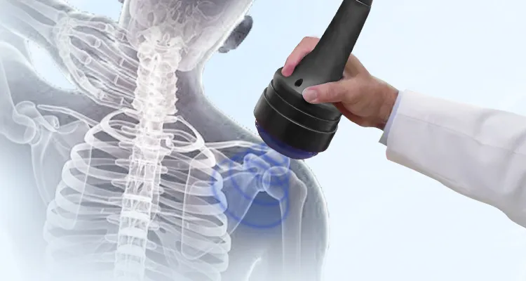 Shockwave Mechanism
