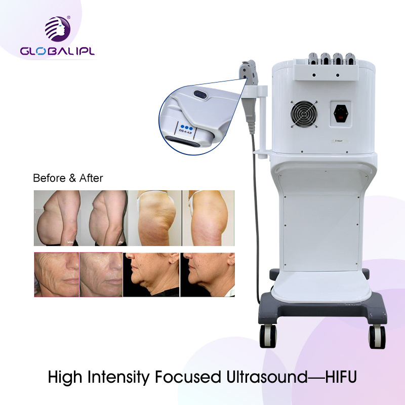 Hifu 2020 Best Face Lifting/Body Slimming 3D Hifu Technology Machine