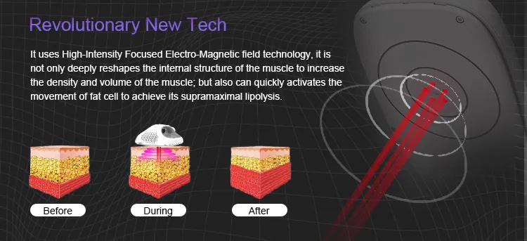 Technology Mechanism