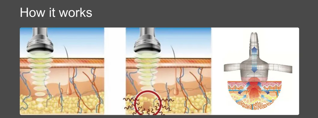 Theory Image 1