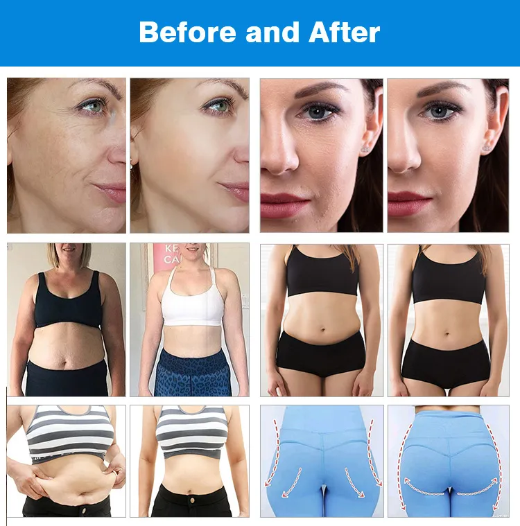 Treatment Results 1