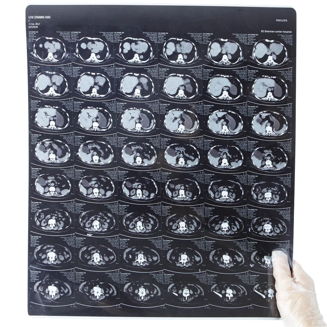 Thermal Imager View 4