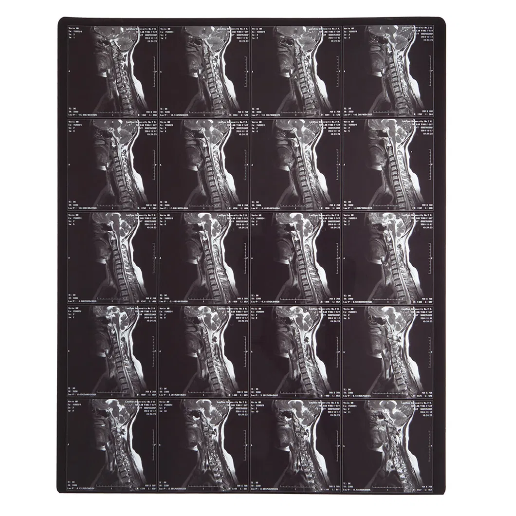 Thermal Imager View 6