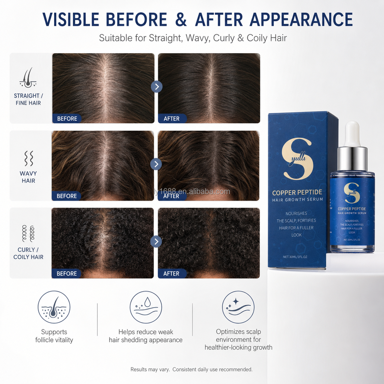 1% Copper Tripeptide Hair Density Serum - Anti-Hair Loss, 9 Botanicals, Oil-Control, No Fragrance