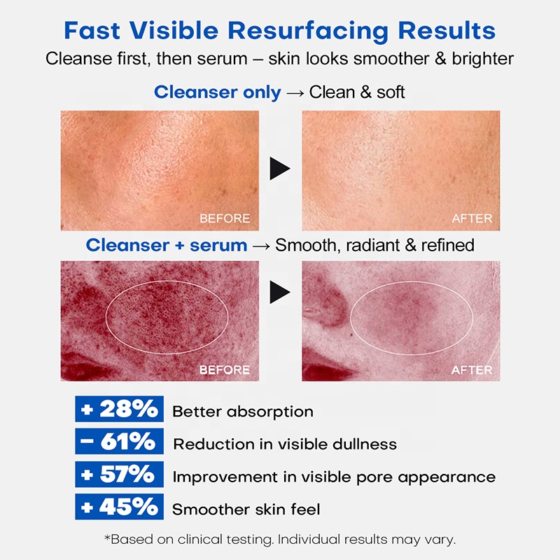 Wholesale New Technology Microneedling Kit PDRN Microcrystalline Cleansing Gel and Anti Wrinkle Serum Set Private Label