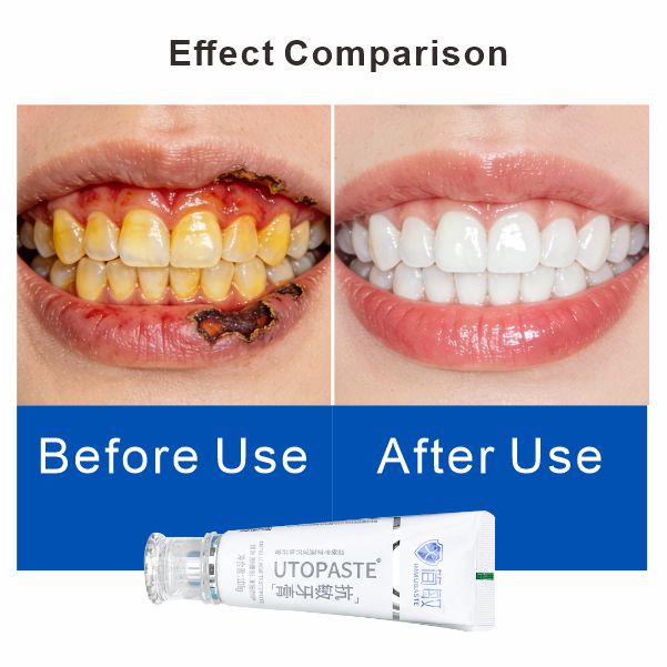 Premium Perio Tartar Care 100g Portable Toothpaste Deep Cleaning Fresh Mint Flavor Herbal Ingredients Whitening Sensitive Teeth