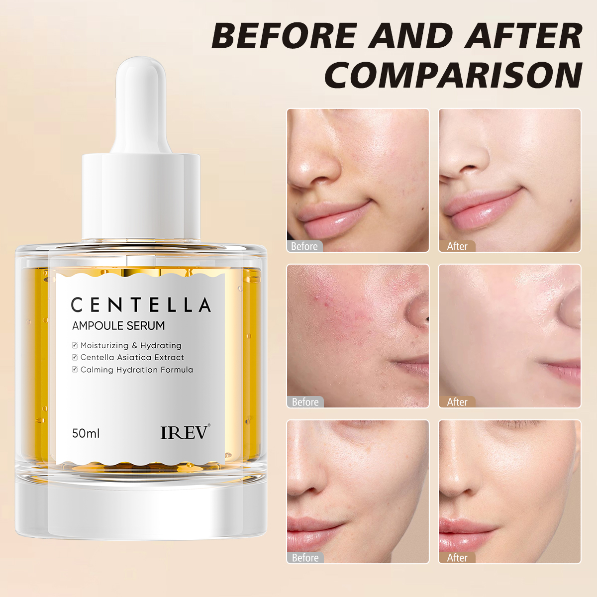 Private Label Madagascar Centella Asiatica Ampoule Facial Serum Soothes Acne Prone And Sensitive Skin