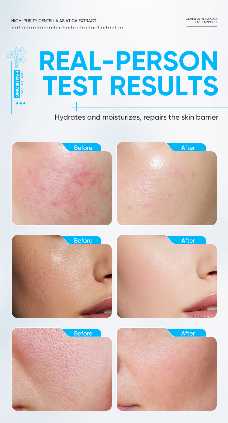 Products Description 10