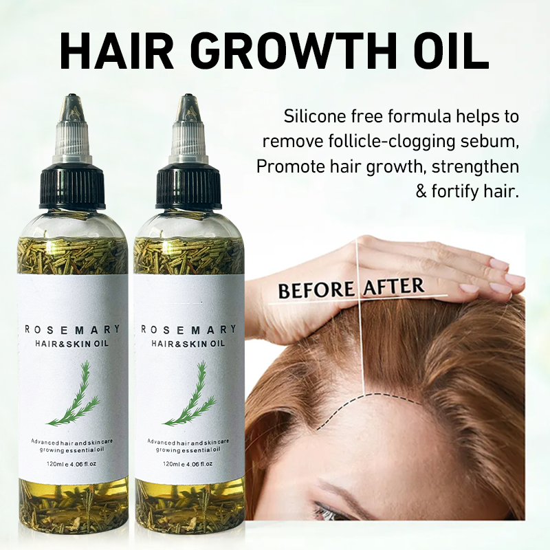 Wholesale In Stock Rosemary Hair Oil 100% Pure Natural Non Greasy Nourish Follicles Strengthening Low MOQ 100 Custom Logo