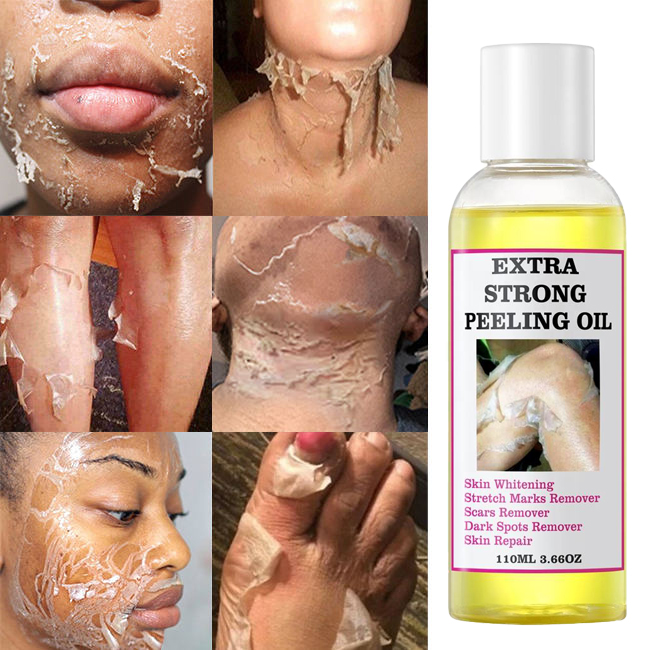 OEM Organic Black Skin Lightening Whitening Peeling Oil Extra Strength Exfoliating Serum For Face Body Private Label 3-Year