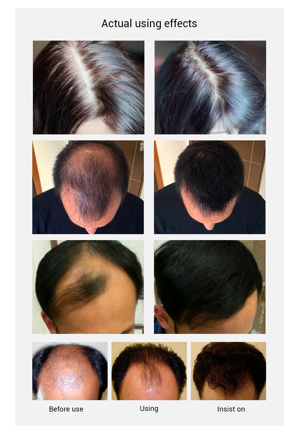 LANBENA Hair Grow Spray Details 5