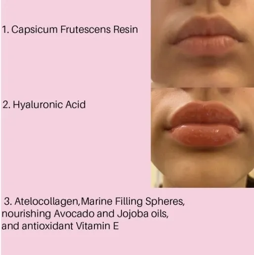Lip Plumper Show 2