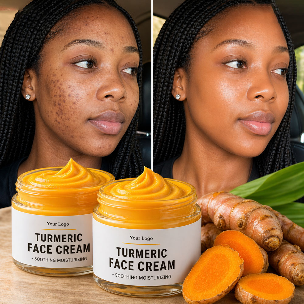 Turmeric Vitamin C Facial Cream For Skin Glow Acne Marks Oil Balance Daily Moisturizing Skincare