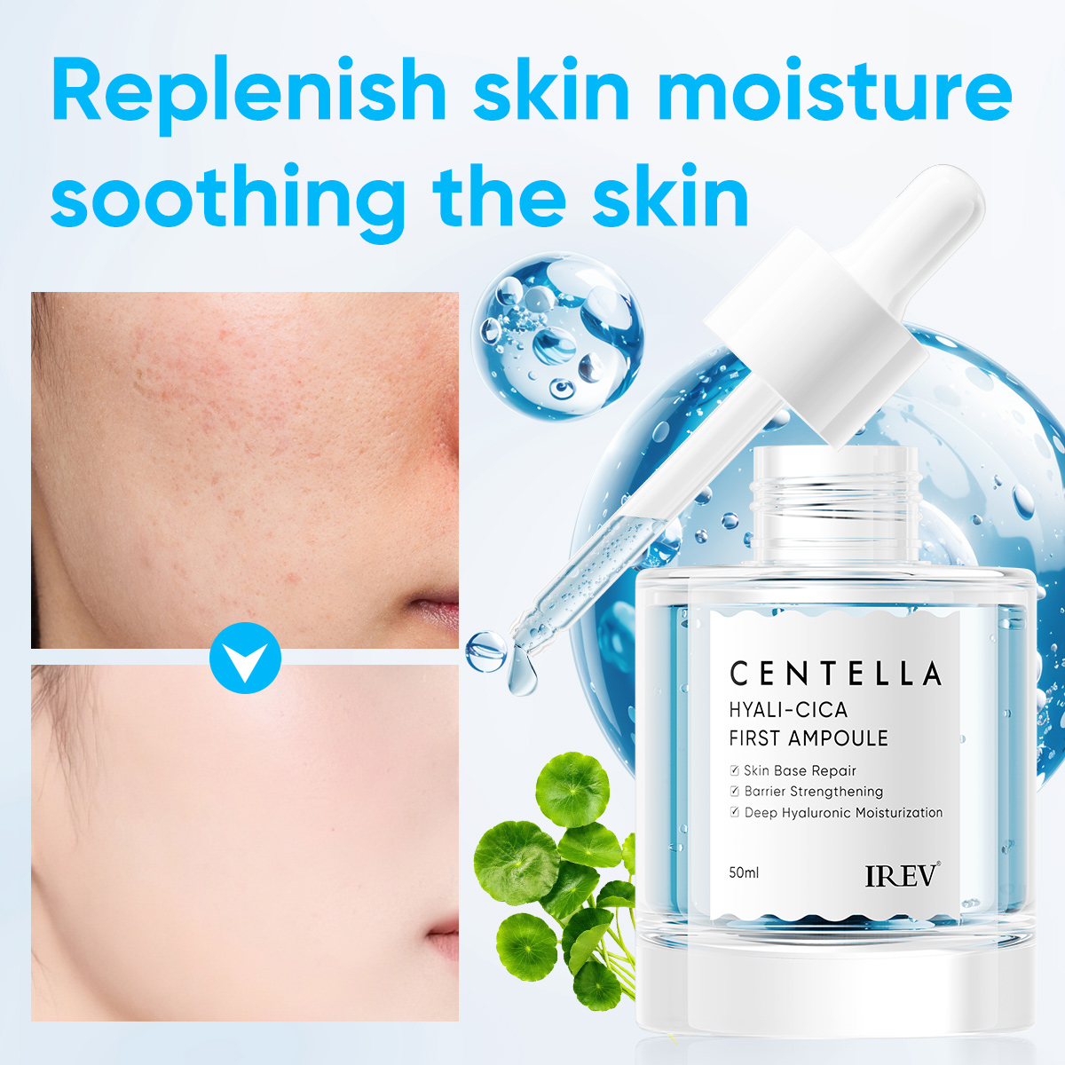 IREV Centella Hyali-Cica Anti-Aging Niacinamide Hydrating Moisturizing Skin Base Repair Face Serum First Ampoule Private Label
