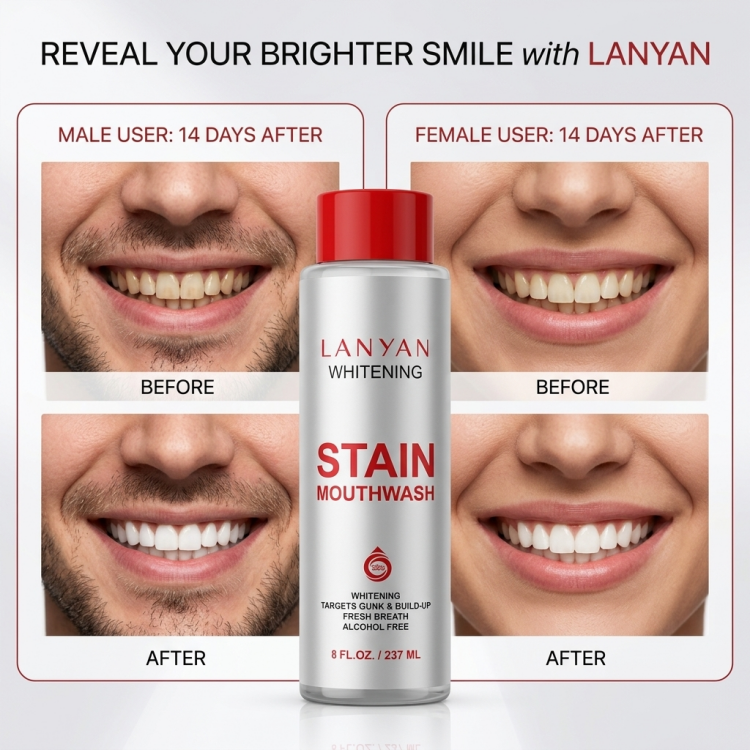 Custom Logo Popular Alcohol Free Removal Teeth Whitening 237ml Private Label Stain Mouthwash