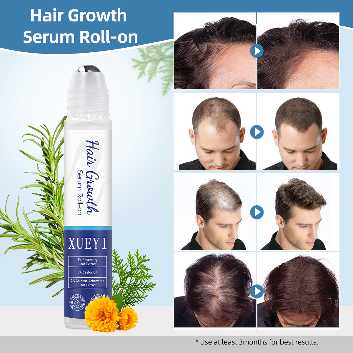 Hair Regrowth Serum And Roller Set 25ml Scalp Care For Thinning Hair Nourishing Massage Applicator Vegan OEM Private Label